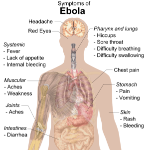 Symptoms_of_ebola